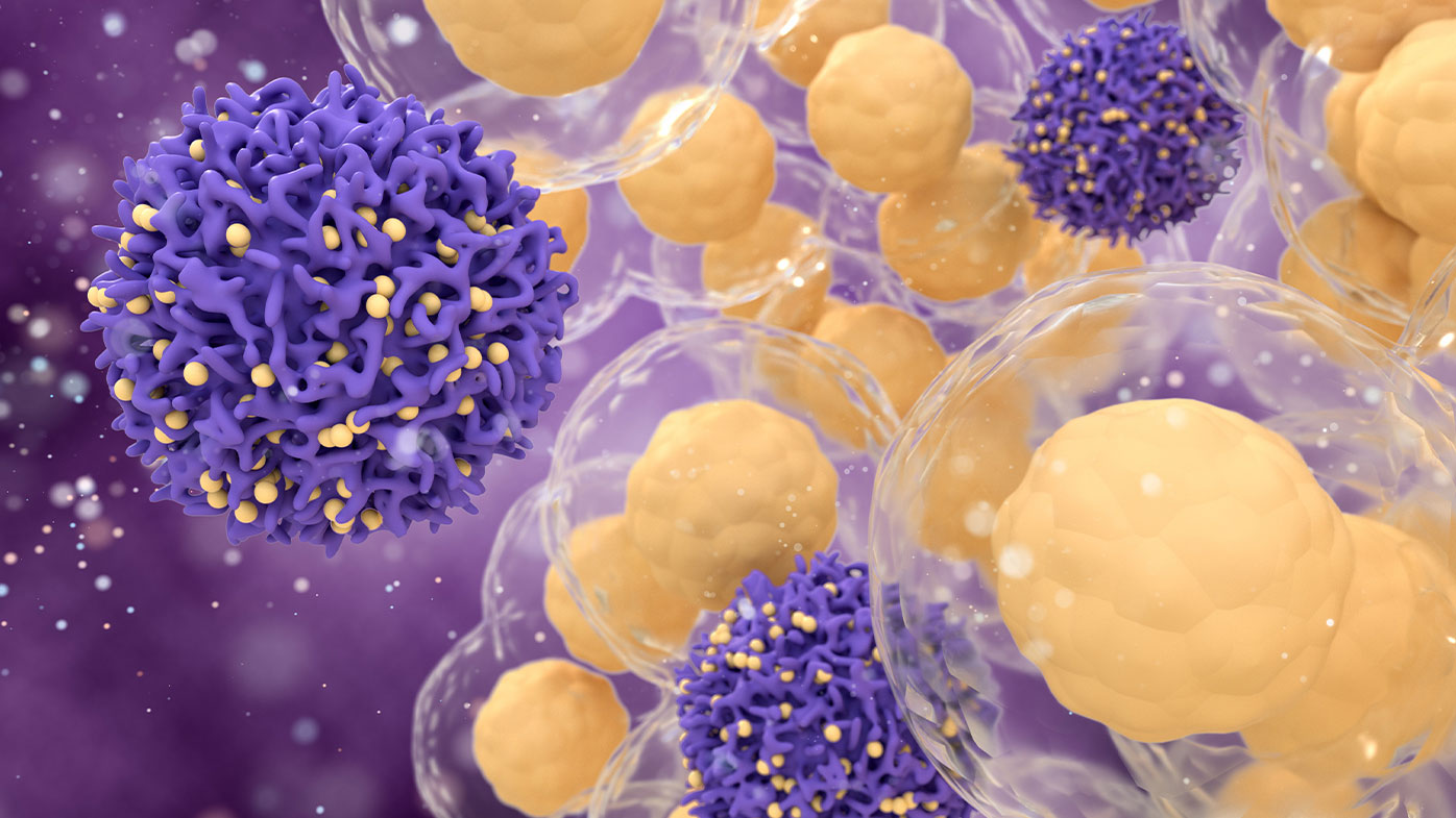 Oncology