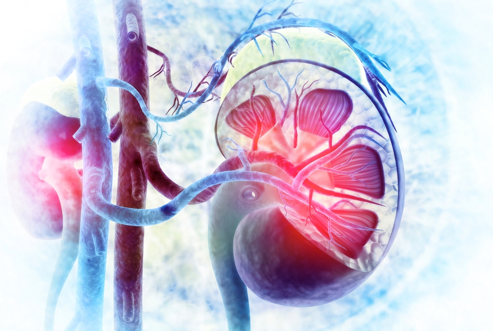Renal Stones and Related Conditions
